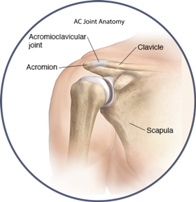 Acromioclavicular (AC) Joint Separation Repair - The Institute for Athletic  Medicine